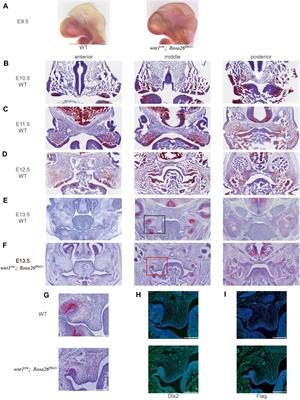 A Neural Crest-specific Overexpression Mouse Model Reveals the Transcriptional Regulatory Effects of Dlx2 During Maxillary Process Development